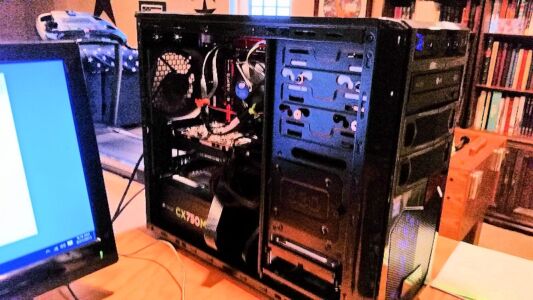 Brain Surgery - Left Lobe Brain Surgery - Left Lobe