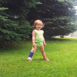 Happy to lose the full leg cast.